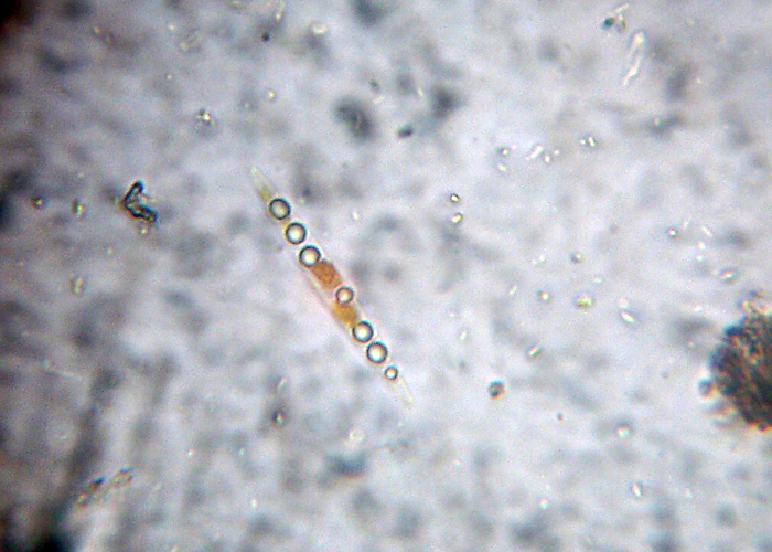 Diatomee marine